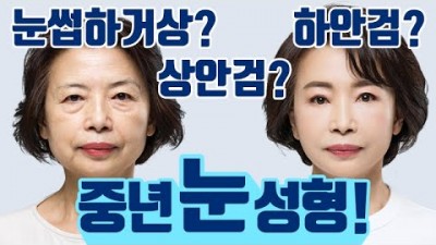 중년 눈성형 눈꺼풀 수술, 눈썹하거상, 상안검, 하안검 수술 대상 및 부작용 정보-강남 신사 테일러성형외과 제공